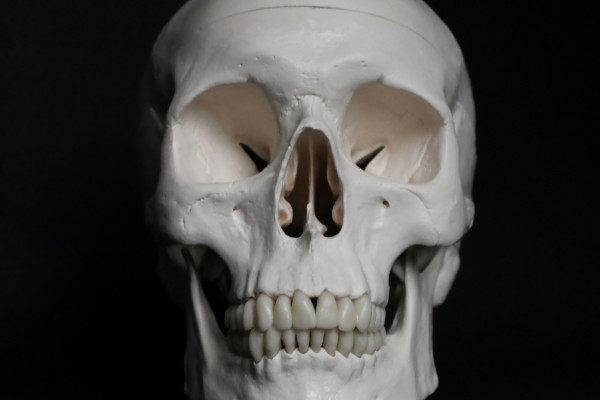 A white anatomical skull model resting on a black surface.
