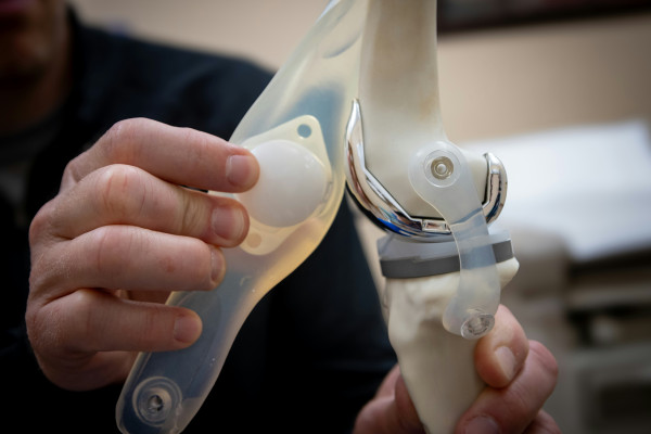 A physician's assistant holding up a knee joint model to explain how the joint moves and stays stable