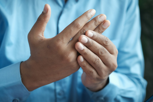 A close-up of a person's hand and wrist, showing visible signs of joint discomfort.